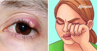 10 Health Signs Your Eyes Might Reveal About Your Body